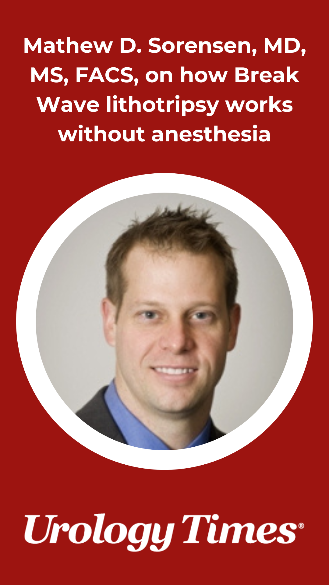 Mathew D. Sorensen, MD, MS, FACS, on how Break Wave lithotripsy works without anesthesia