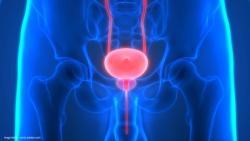 New guideline on neurogenic lower urinary tract dysfunction emphasizes risk management