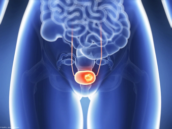 Bladder Cancer