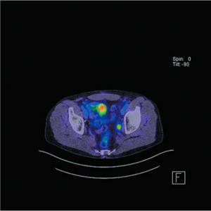 Photo courtesy of Mark Frydenberg, MD