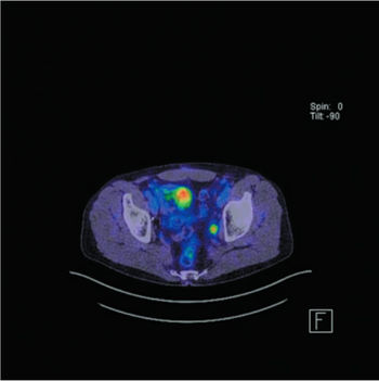 Photo courtesy of Mark Frydenberg, MD