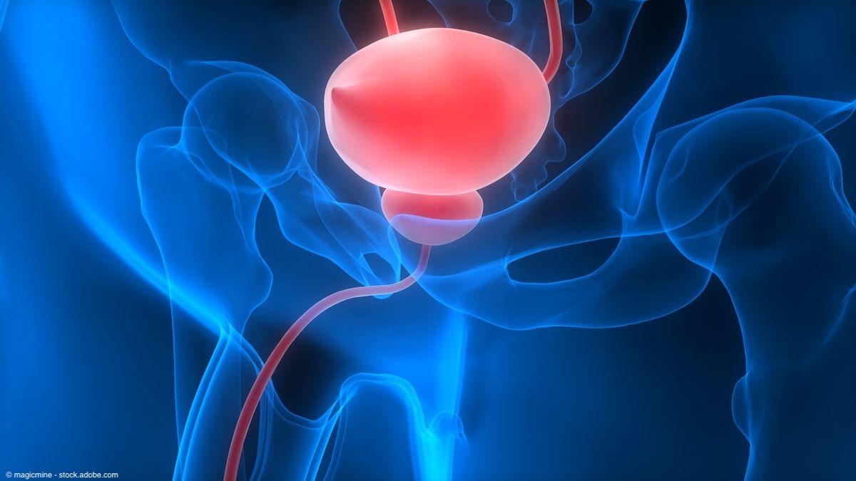 Urologic surgeons successfully complete world’s first bladder transplant Urologic surgeons successfully complete world’s first bladder transplant