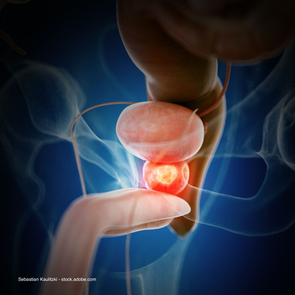 Sebastian Kaulitzki - stock.adobe.com