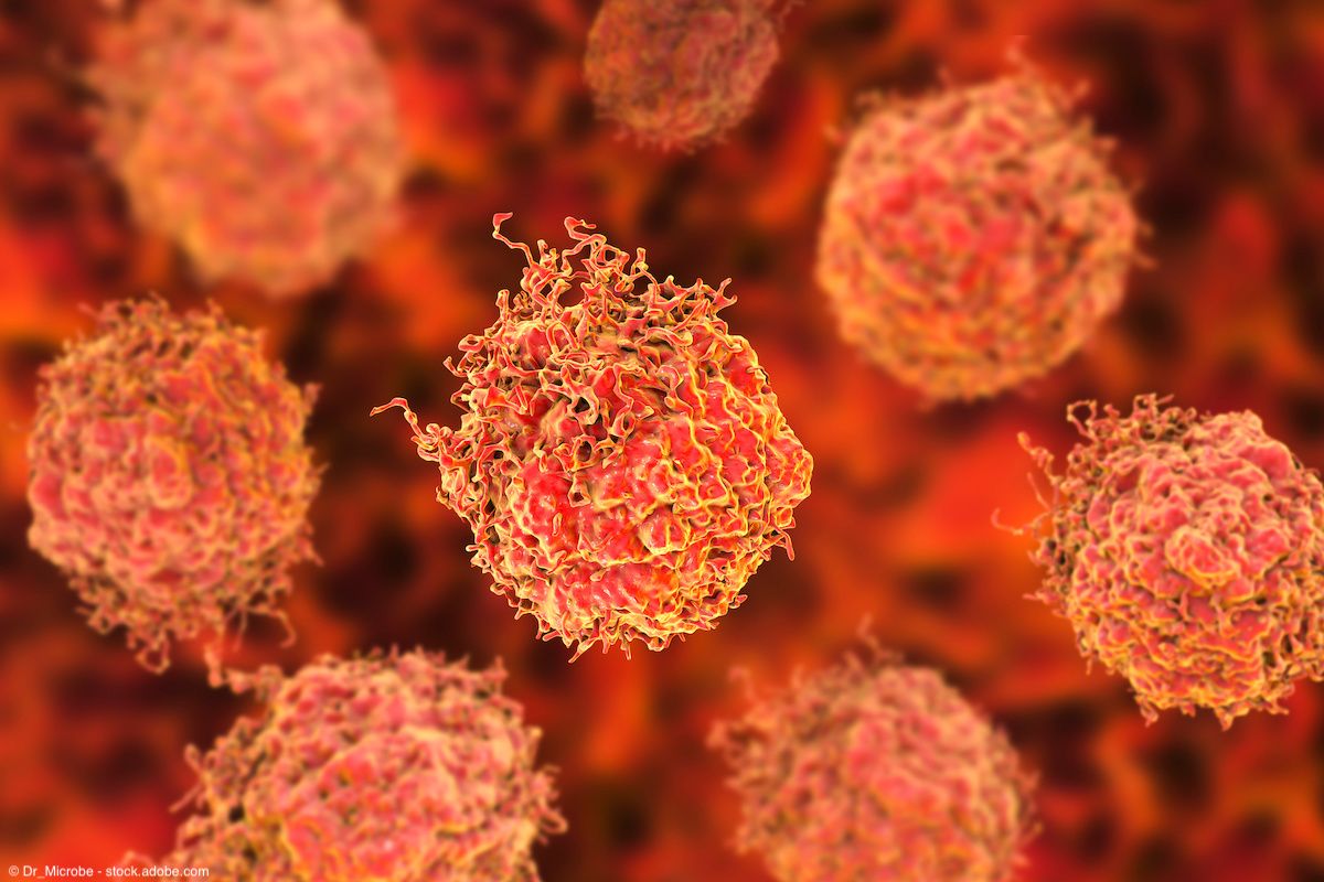 Prostate cancer cells, 3D illustration| © Dr_Microbe - stock.adobe.com