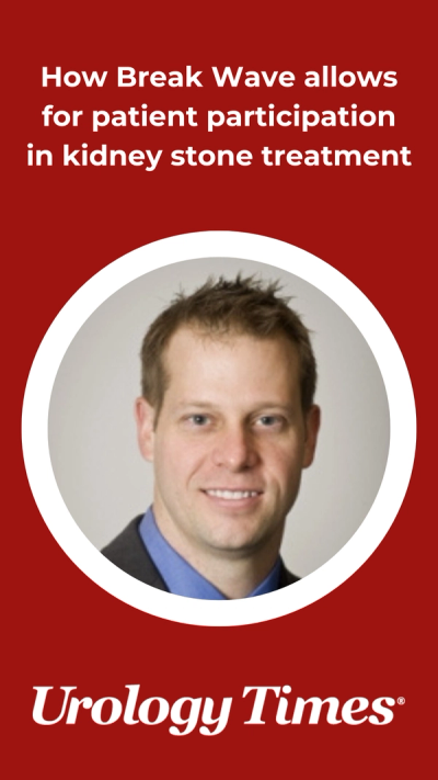 How Break Wave allows for patient participation in kidney stone treatment