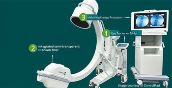 ControlRad Trace - Image courtesy of ControlRad