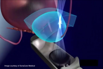 Image courtesy of SonaCare Medical