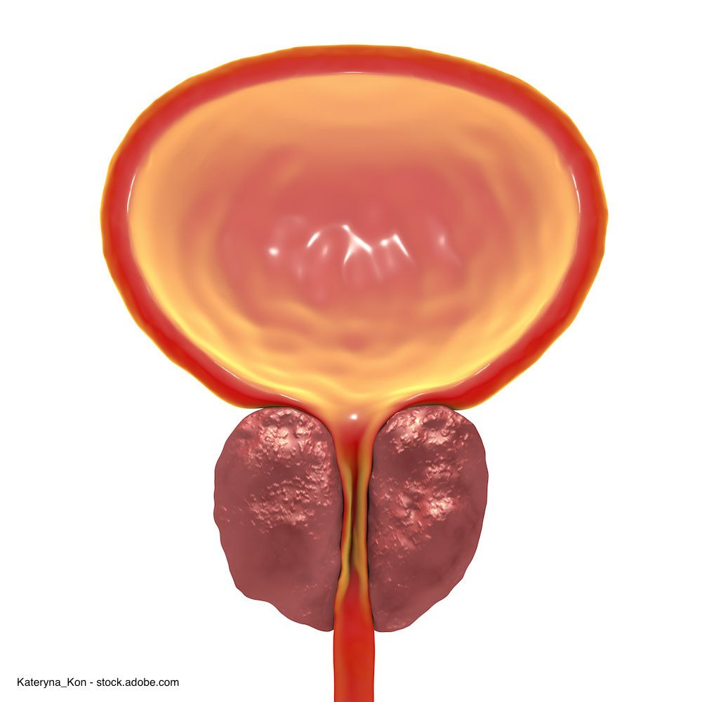 Kateryna_Kon - stock.adobe.com