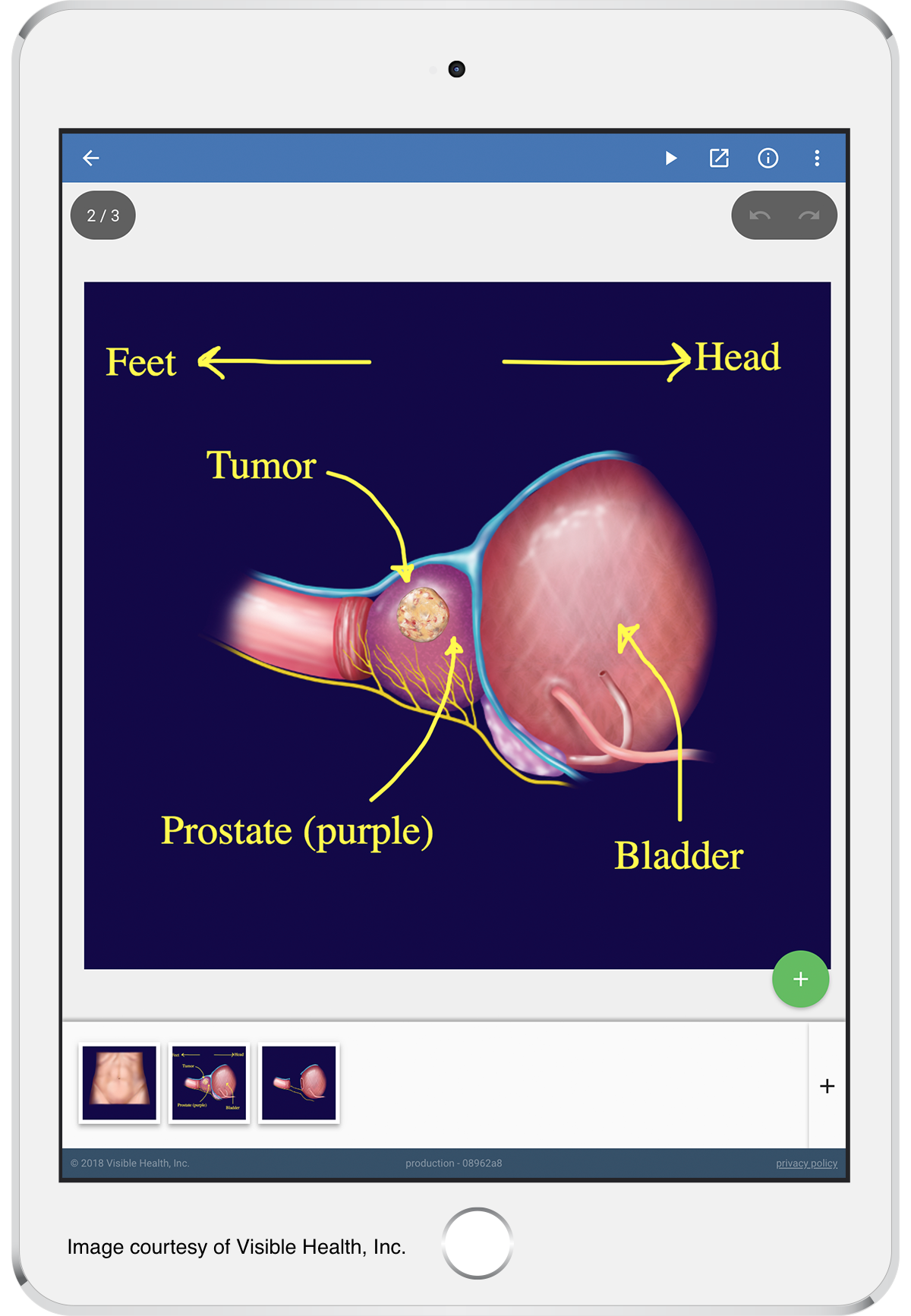 Image courtesy of Visible Health, Inc.