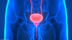 iRARC adoption is slow but persistent in bladder cancer