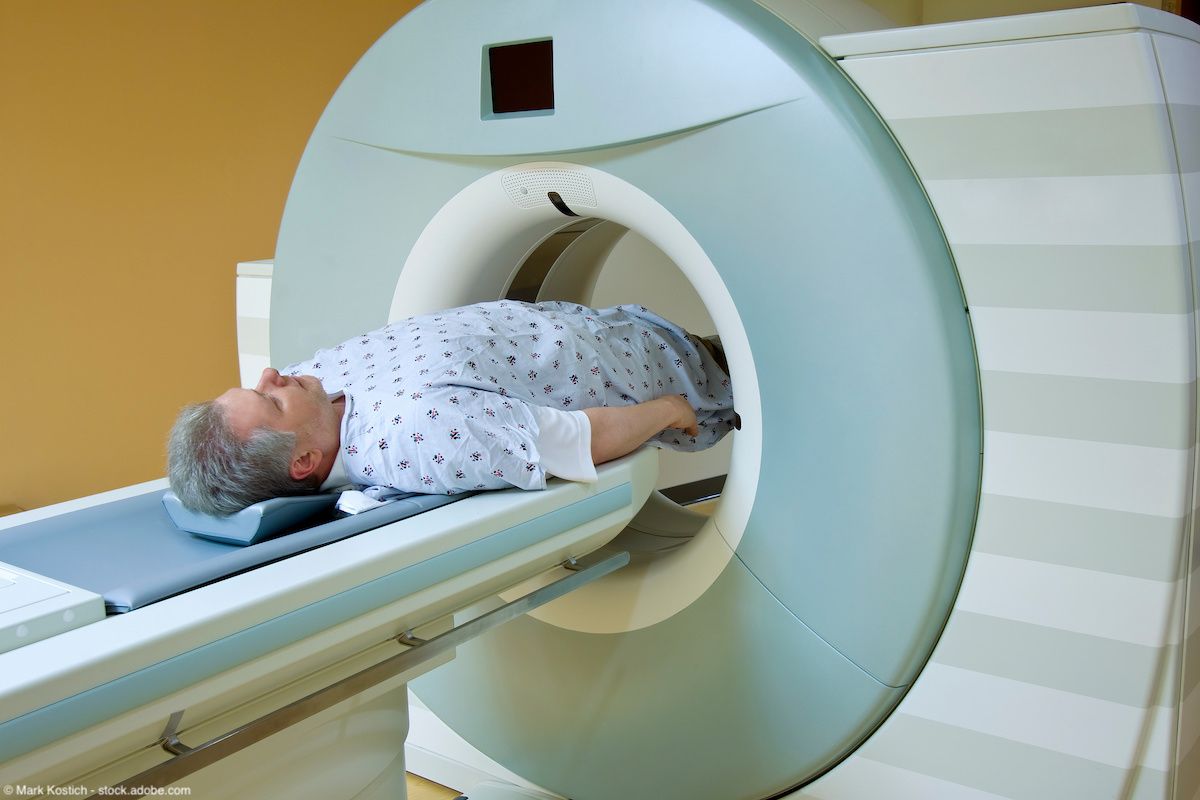 Man Receiving Medical Scan for Prostate Cancer Diagnosis | Image Credit: © Mark Kostich - stock.adobe.com 