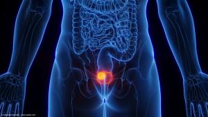 Illustration of bladder cancer | Image Credit: © Sebastian Kaulitzki - stock.adobe.com 