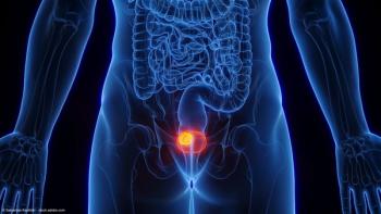 Illustration of bladder cancer | Image Credit: © Sebastian Kaulitzki - stock.adobe.com
