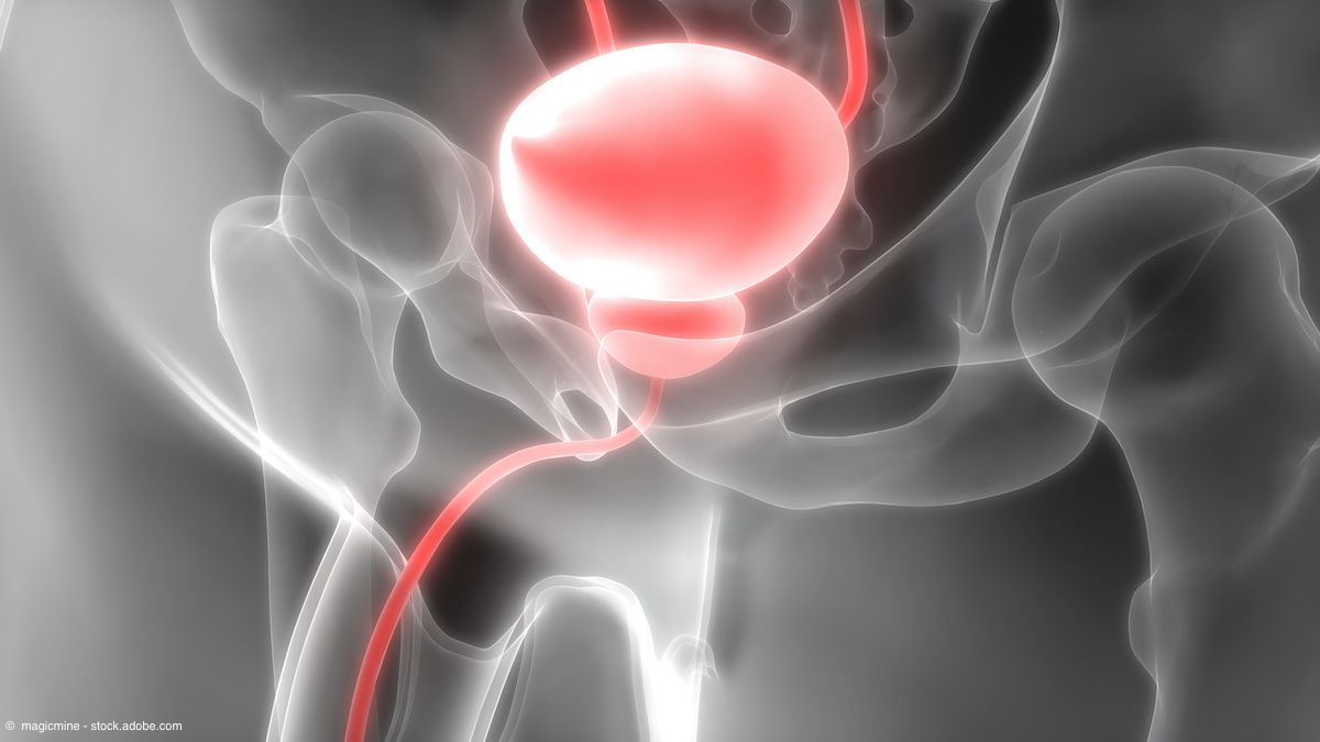“64Cu SAR-bisPSMA was able to detect disease outside of the primary lesion that was not detected with 68Ga PSMA-11,” said Louise Emmett, MD, MBChB, BSc. 