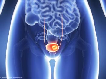 3d rendered illustration - bladder cancer | Image Credit: © Sebastian Kaulitzki - stock.adobe.com
