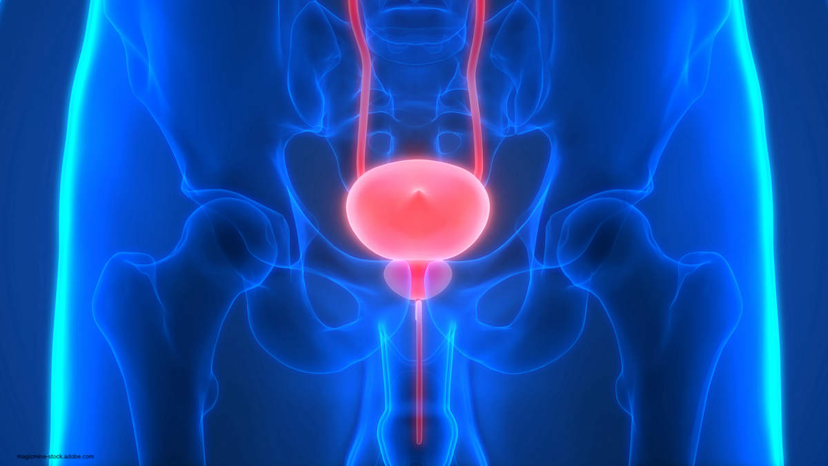 medical rendition of an xray of human bladder