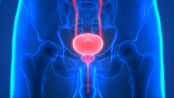 medical rendition of an xray of human bladder