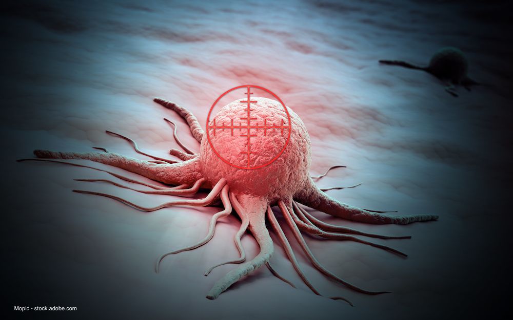 Mopic - stock.adobe.com