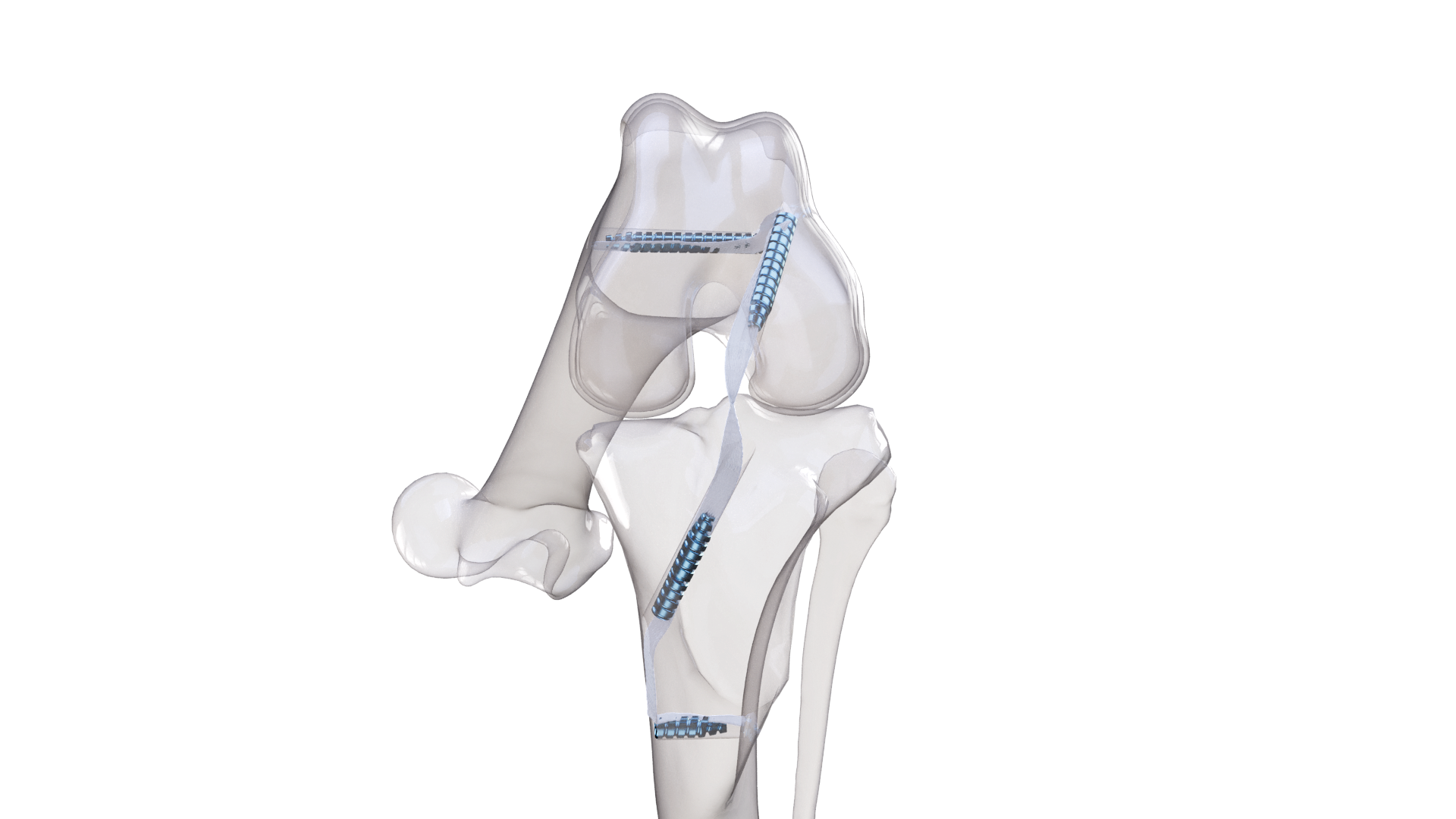 Image chirurgie