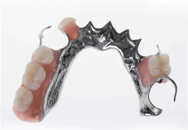 Chrome Dentures