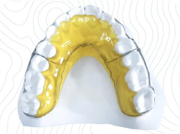 Begg Retainer