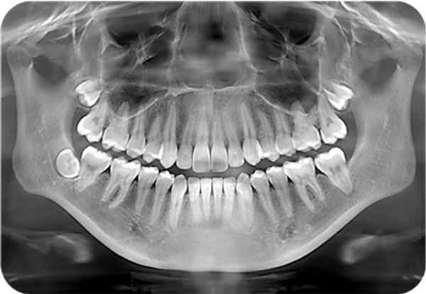 X-Rays
