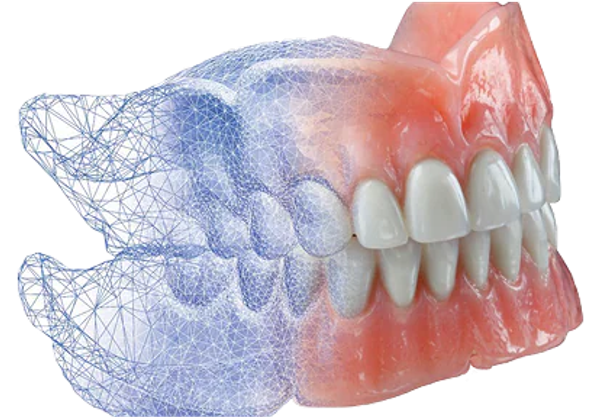 Digital Dentures