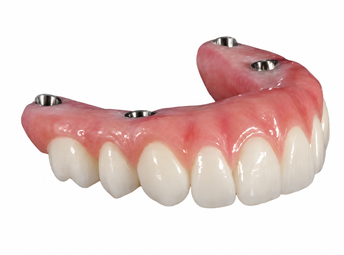 complete dentures
