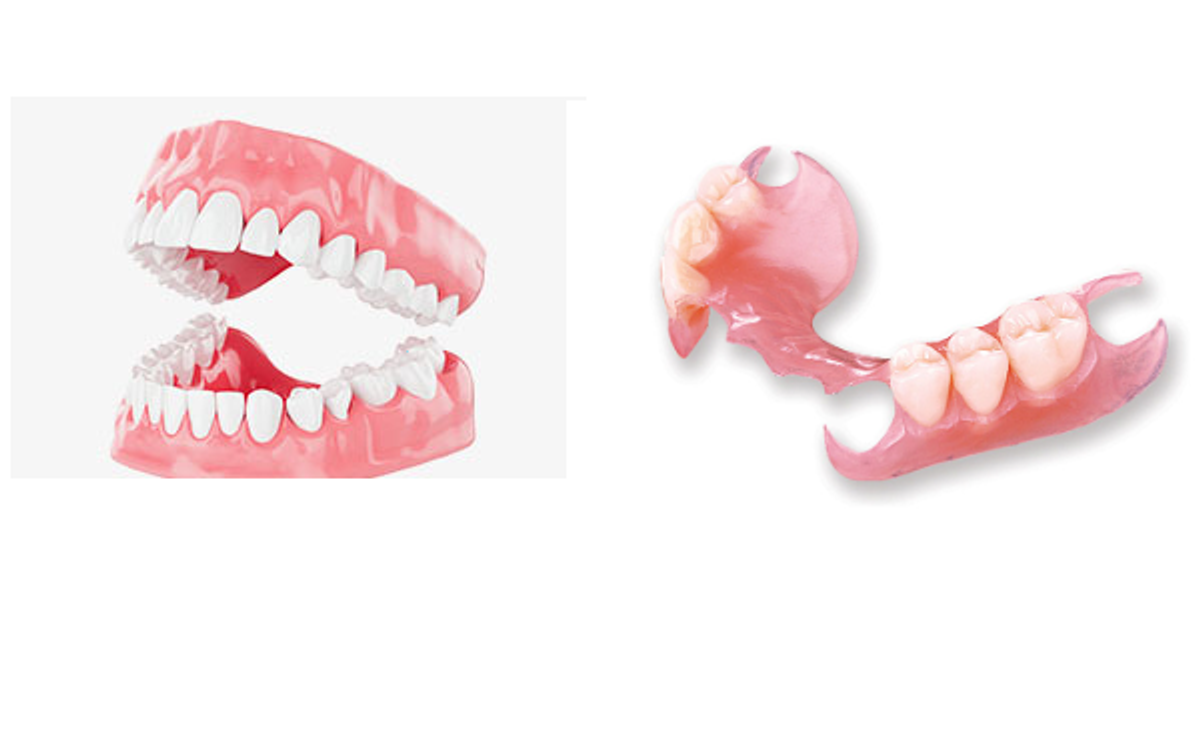 complete vs partial dental