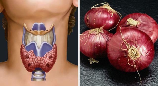 How to treat thyroid with onions