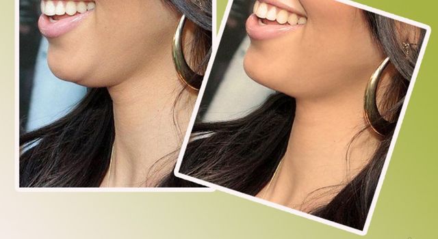 How to get rid of double chin