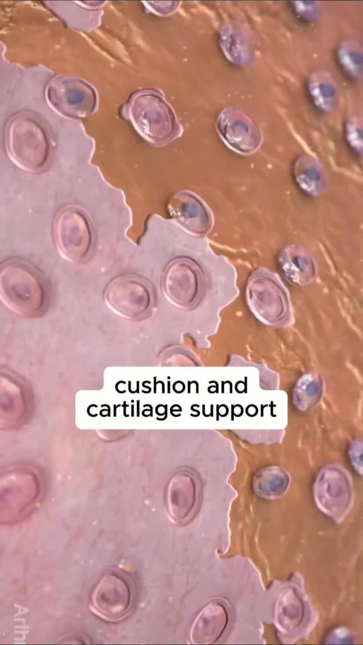 Animated: cushion and cartilage support