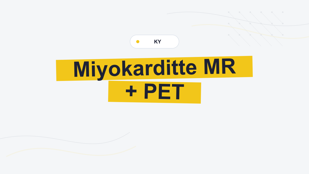 Miyokarditte MR ve FDG-PET Uyumu Daha Yüksek Olay Riskiyle İlişkili