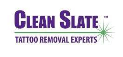 Clean Slate Tattoo Removal
