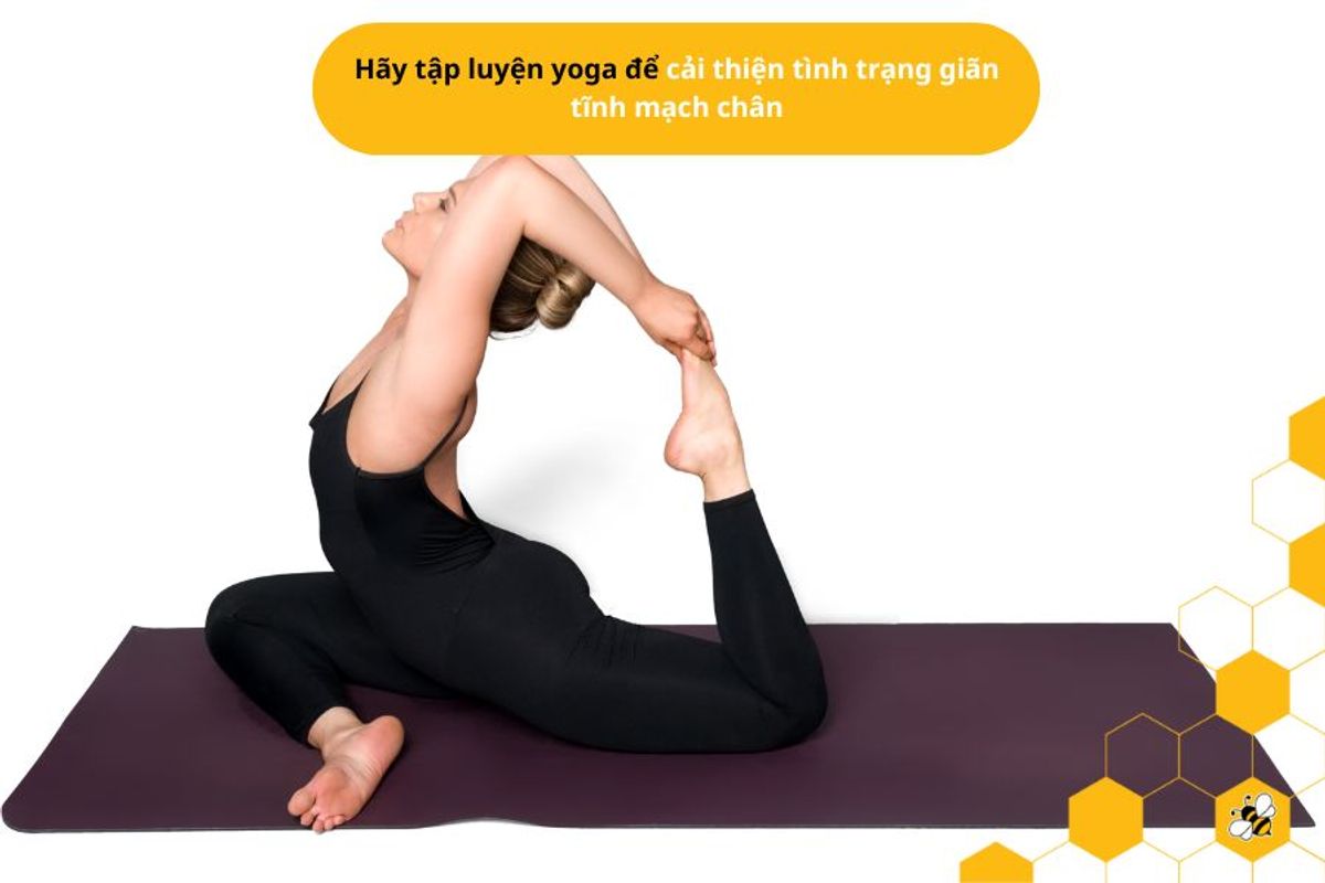 Hãy tập luyện yoga để cải thiện tình trạng giãn tĩnh mạch chân