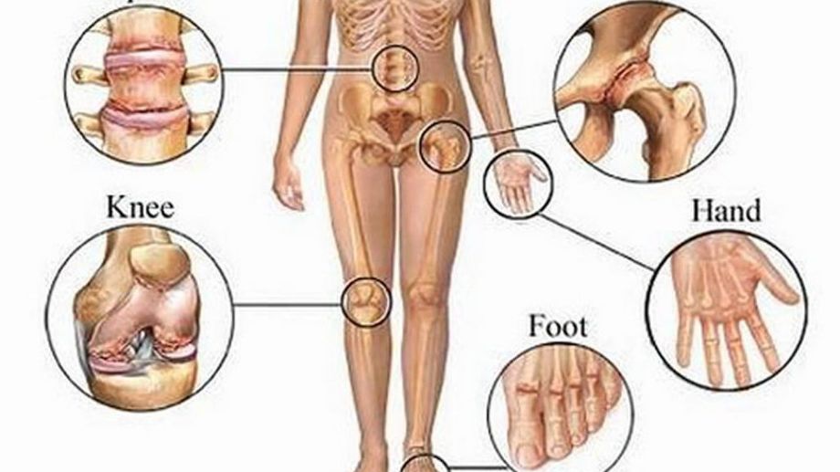 Yoga trị liệu xương khớp