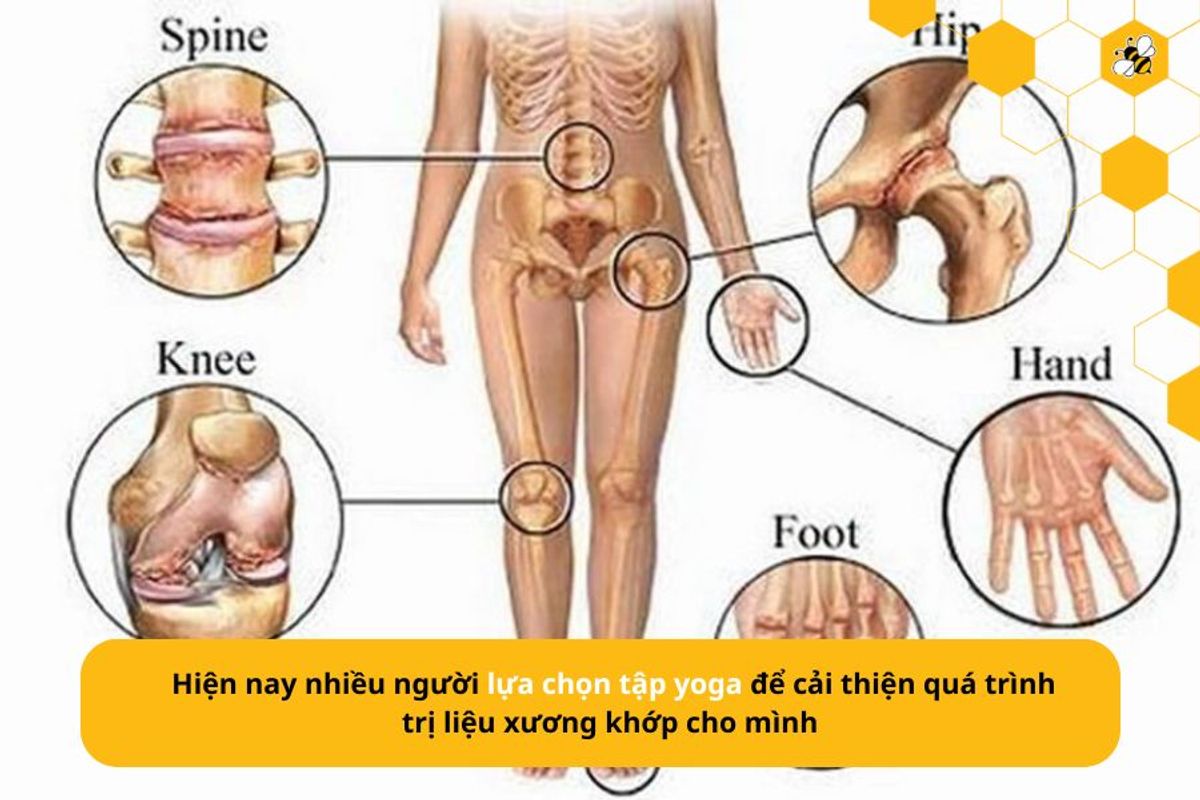 Hiện nay nhiều người lựa chọn tập yoga để cải thiện quá trình trị liệu xương khớp cho mình