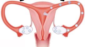 Bài tập yoga chữa tắc vòi trứng