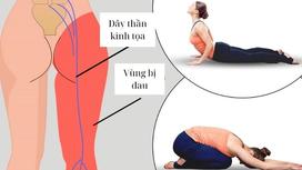 Bài tập yoga chữa đau thần kinh tọa