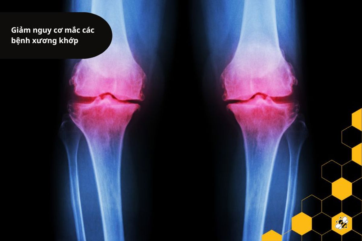 Giảm nguy cơ mắc các bệnh xương khớp