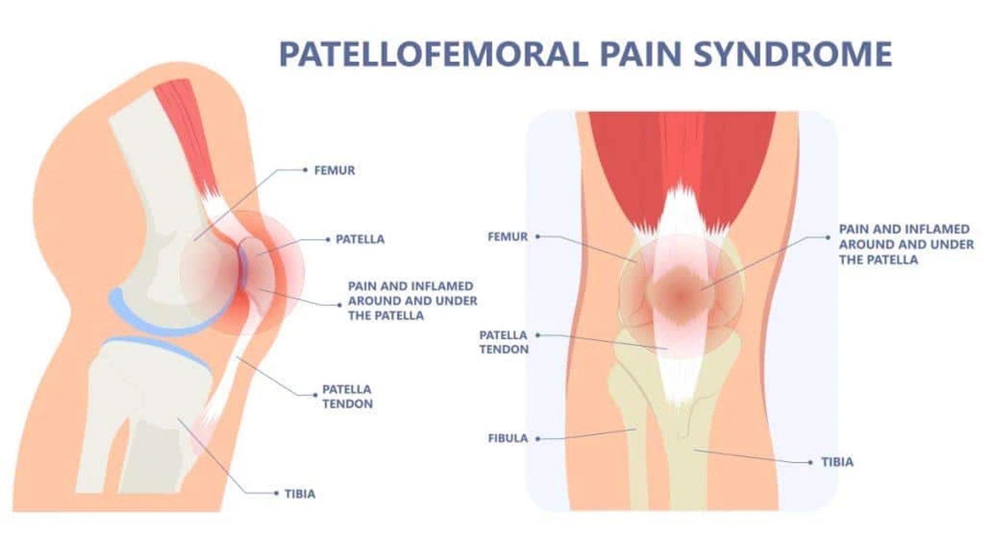 Knee diagram