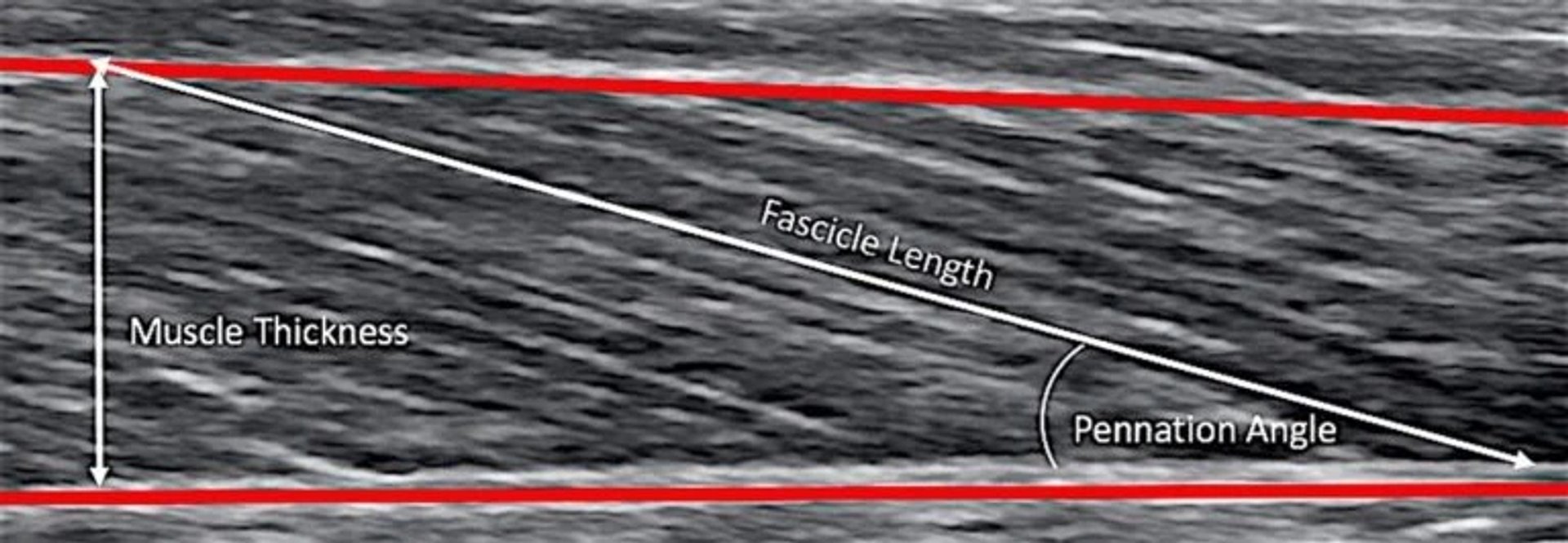 Muscle fibre diagram