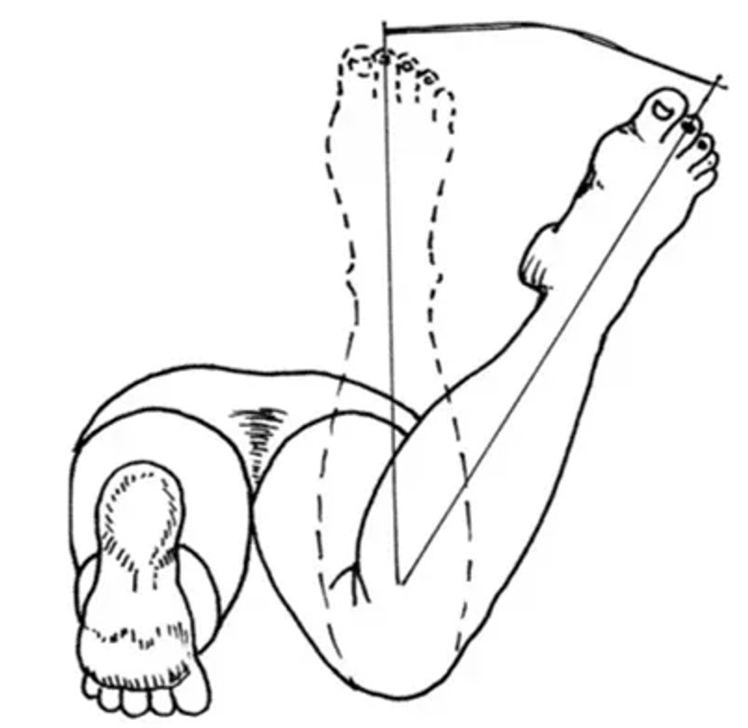 Hip internal rotation diagram