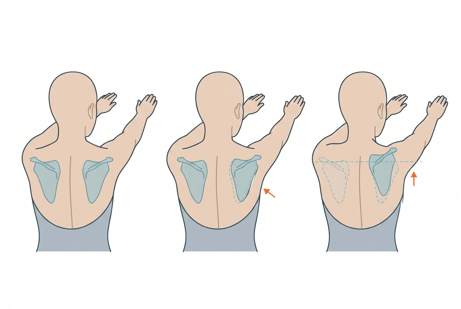 Rear three-quarter view of a person with arms raised to shoulder height in three panels: shoulder blades sitting flat, one shoulder blade lifting off the ribcage, and one shoulder shrugging higher than the other.