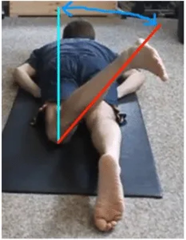 Hip external rotation diagram