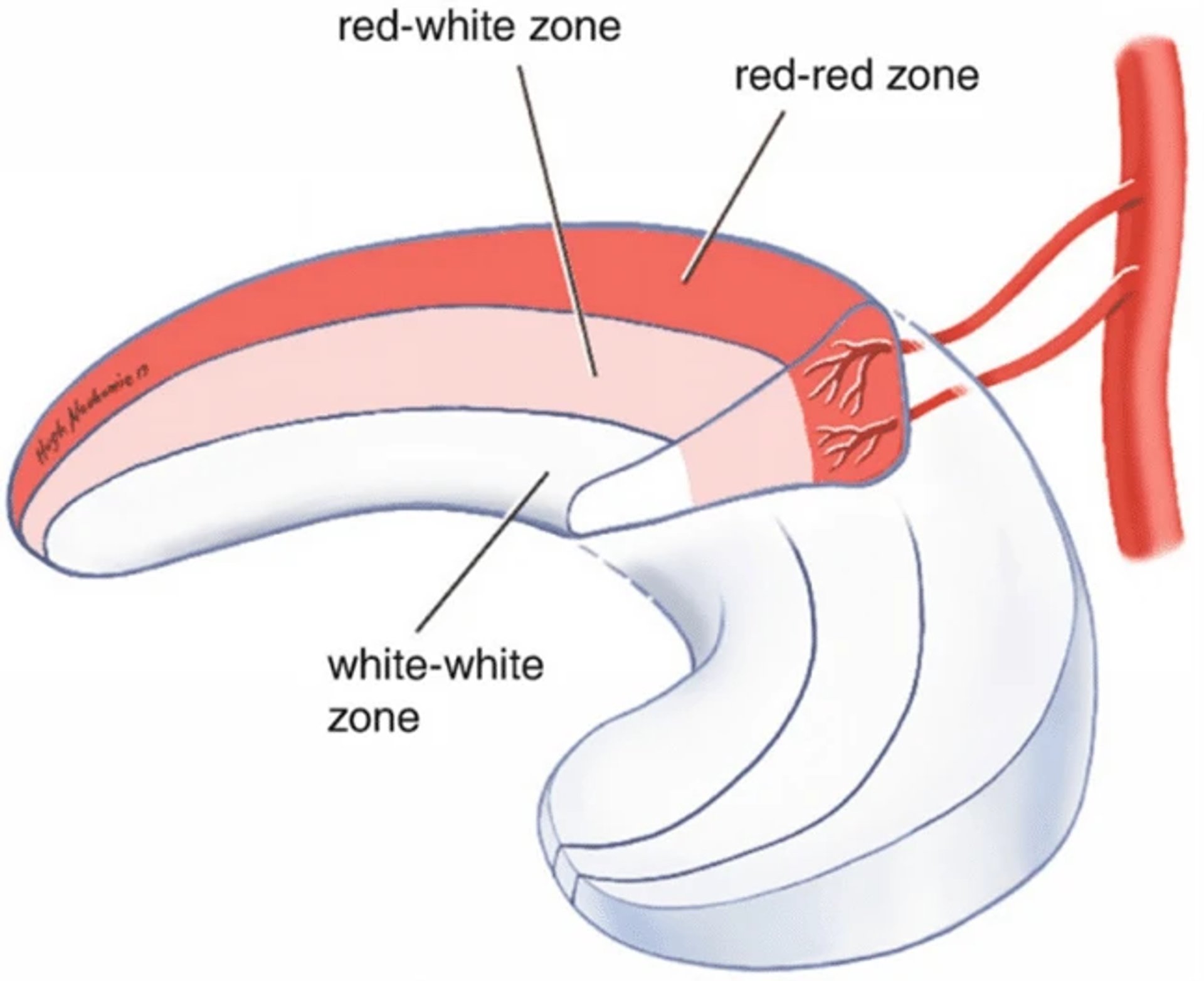 Meniscus diagram