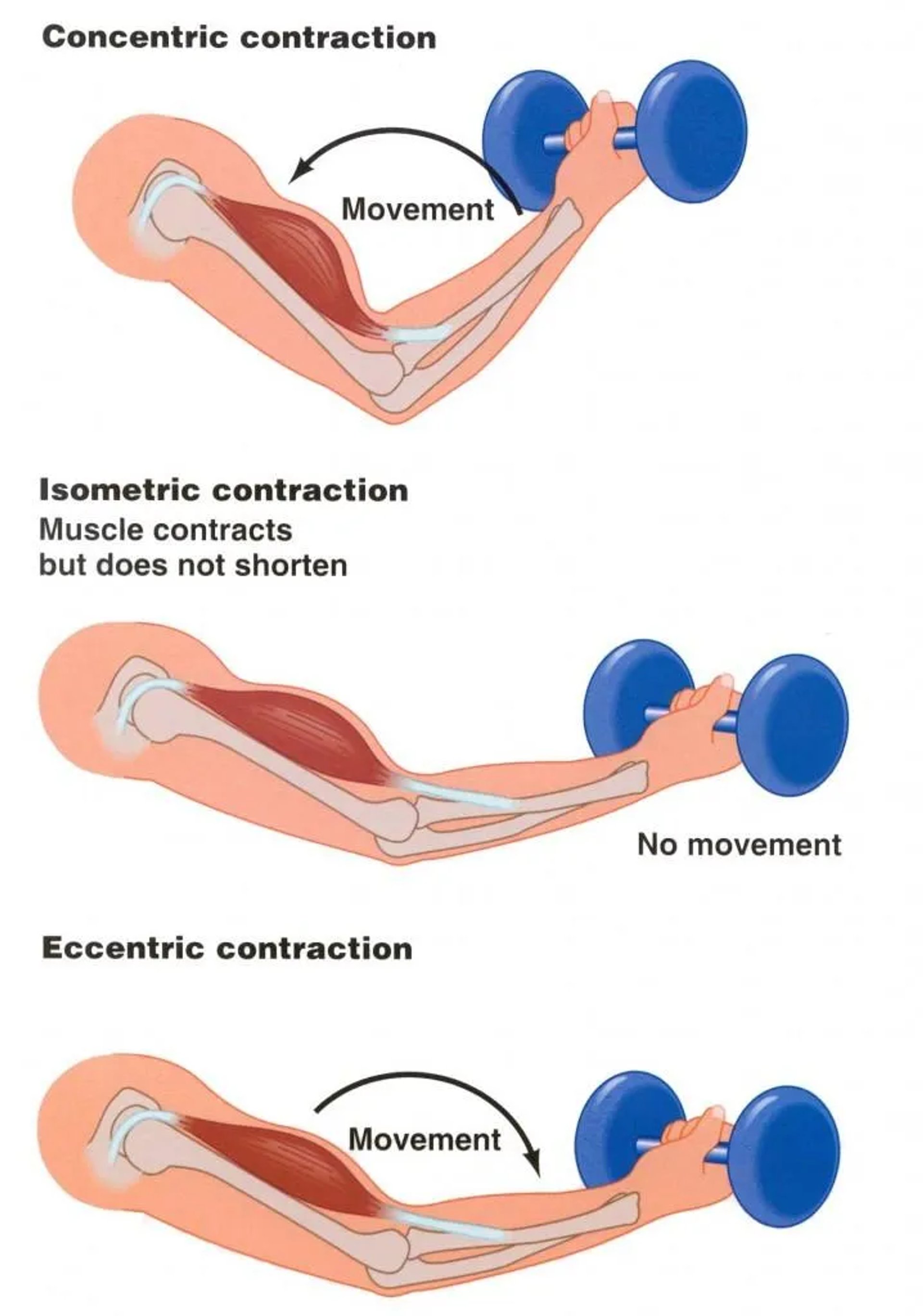 Contraction diagram