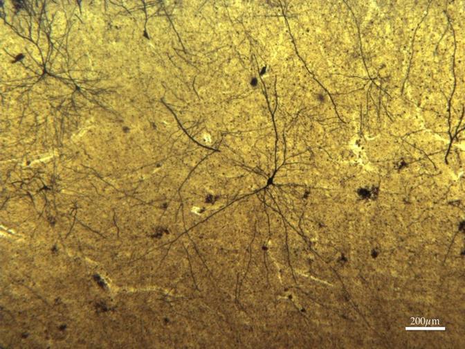 Elephant cerebral cortex & neuronal characteristics