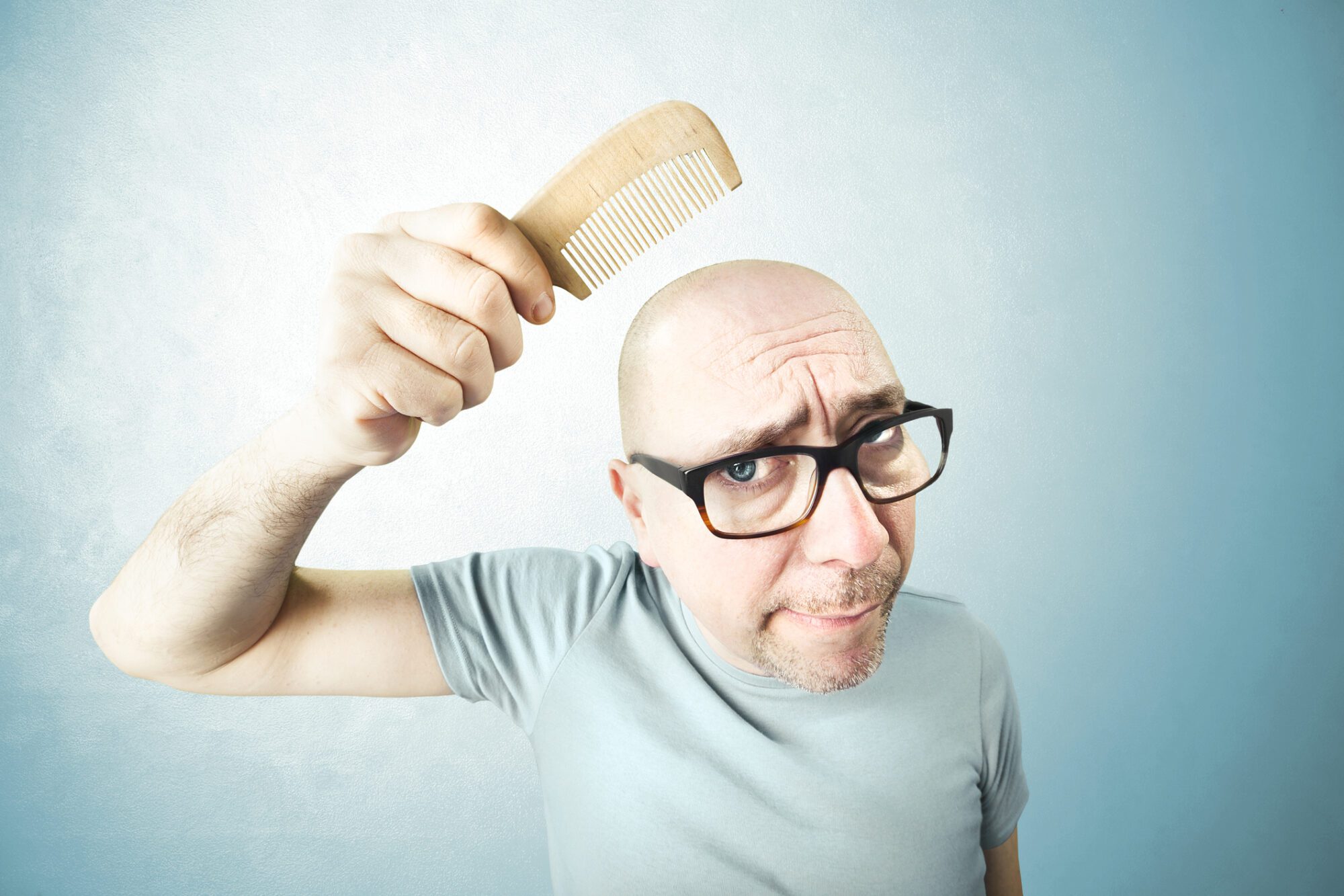 Desmitificando la Alopecia: Mitos y Realidades