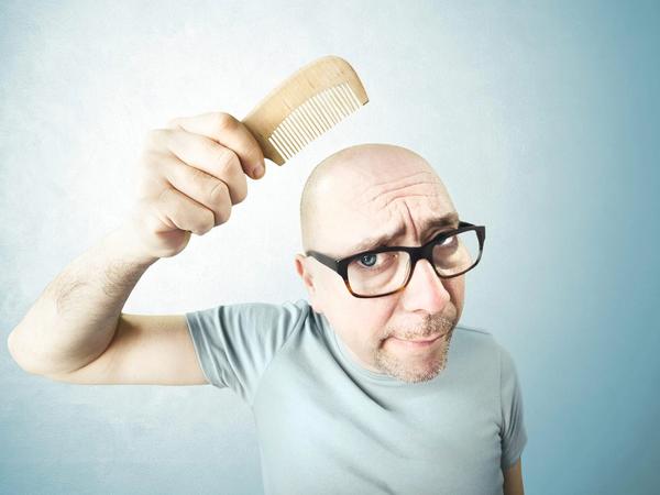 Desmitificando la Alopecia: Mitos y Realidades